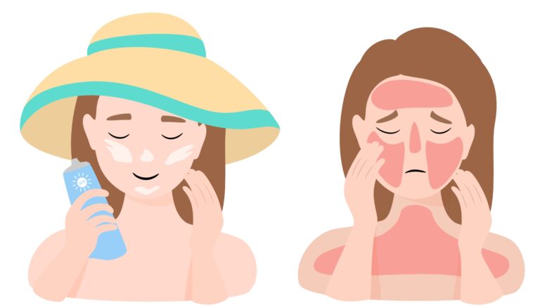 Sunscreen Unveiled: Expert Truths & Myths